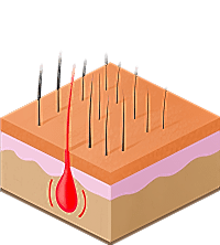 энергия проводится вниз по волосу воздействуя на фолликулу