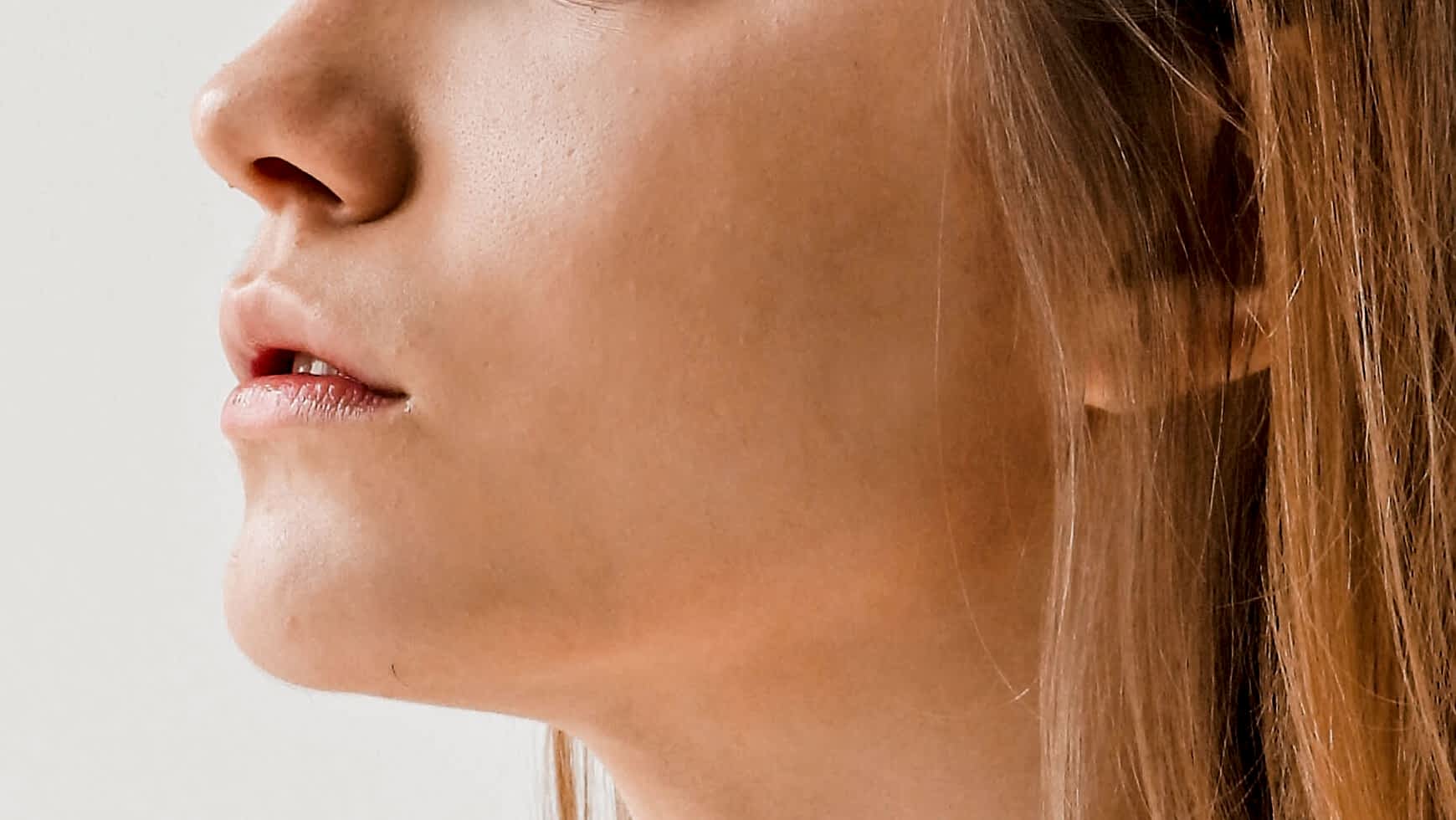 Лазерная эпиляция щек