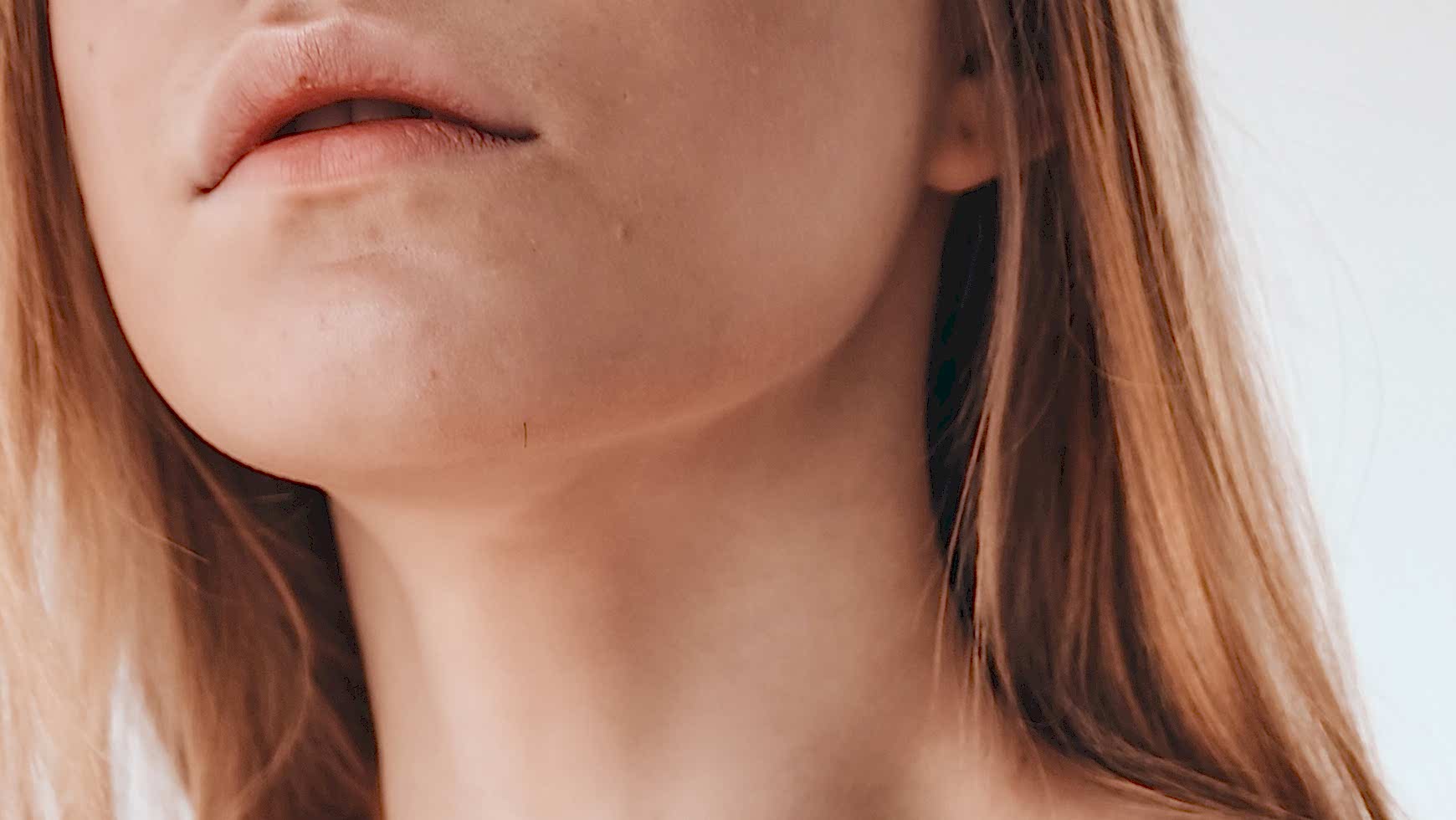 Лазерная эпиляция подбородка