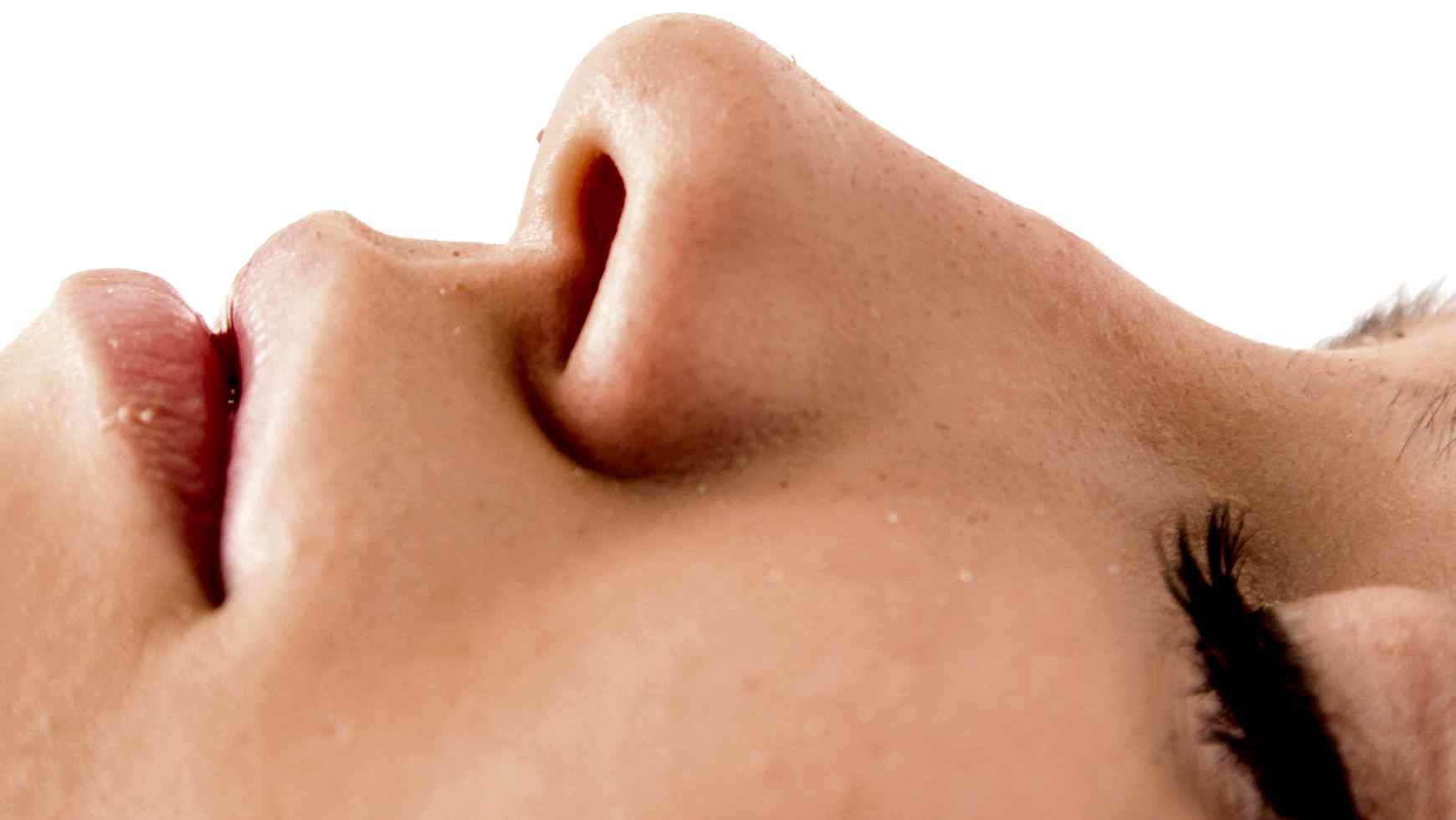 Лазерная эпиляция щек