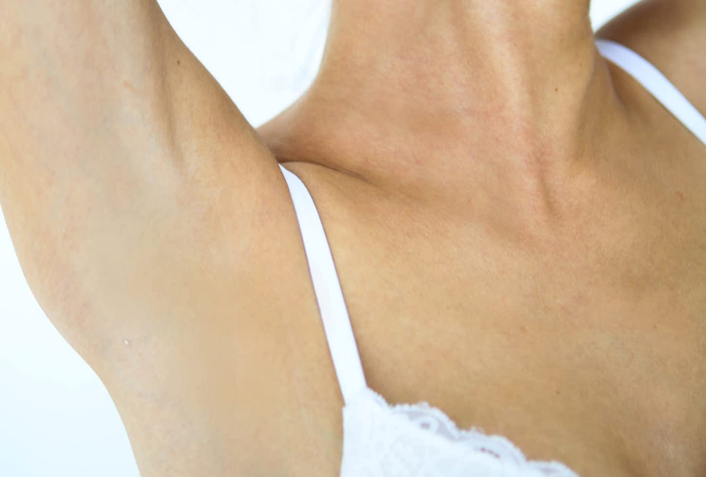 Лазерная эпиляция подмышек