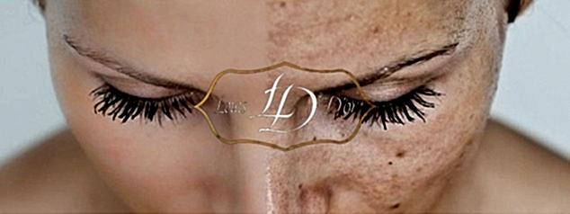 Эффект от карбонового пилинга