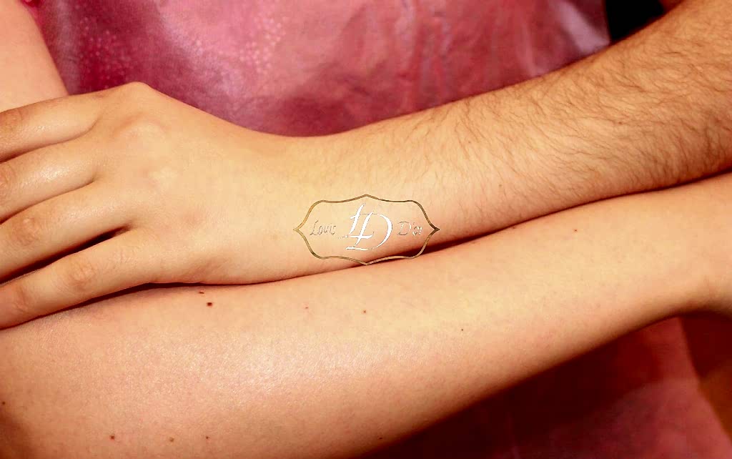 До и после лазерной эпиляции рук