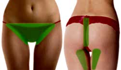 Лазерная эпиляция бикини: глубокое